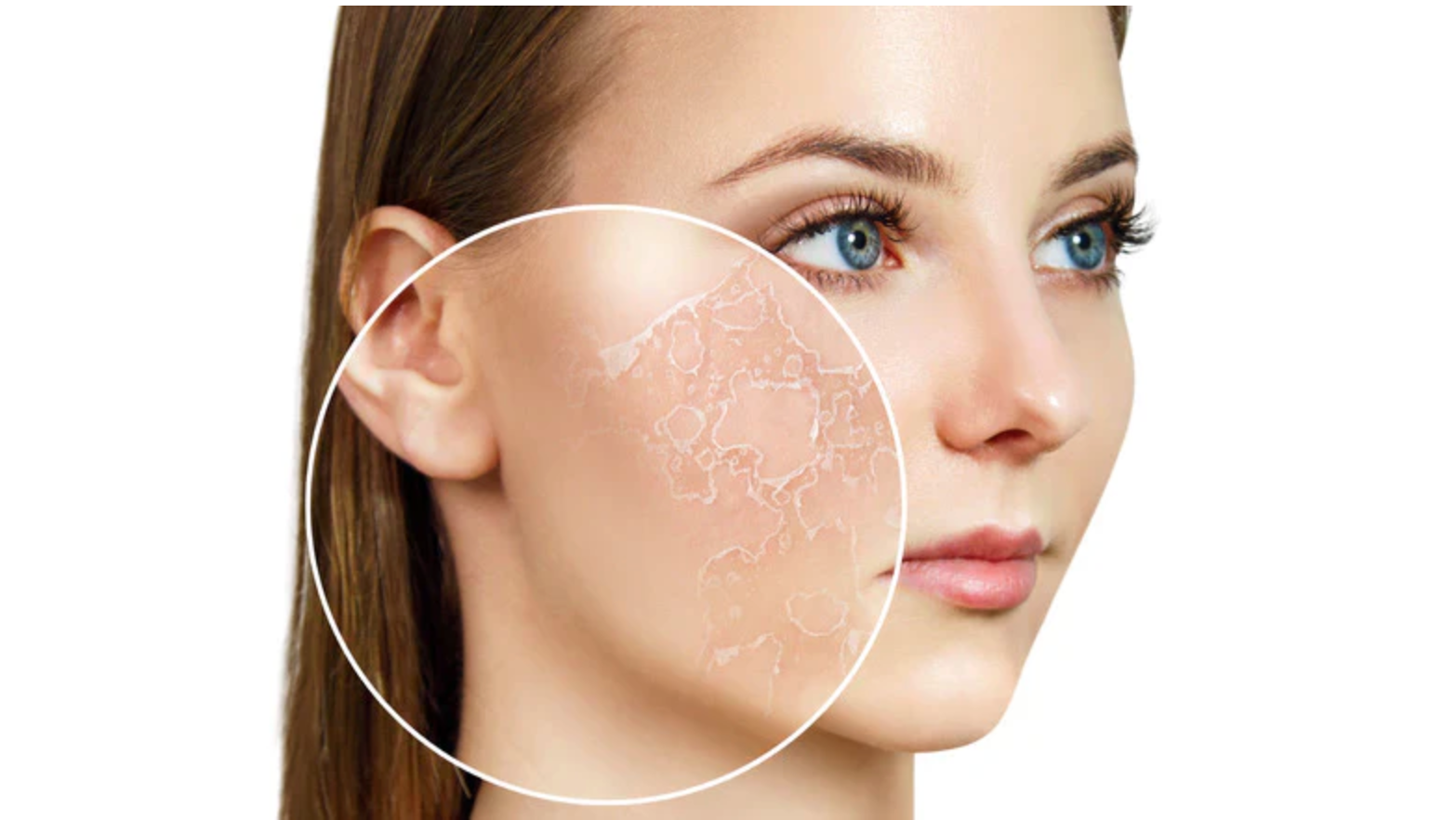 Our Ultimate Guide To The Four Skin Types Part One: All About Dry Skin