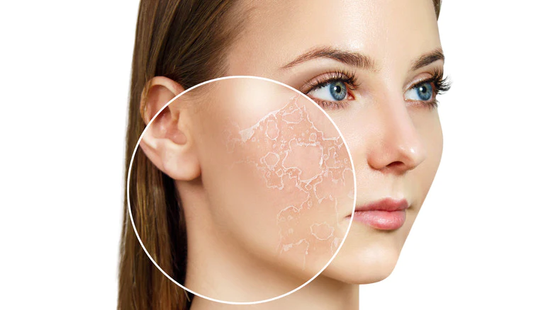 Our Ultimate Guide To The Four Skin Types Part One: All About Dry Skin